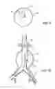 Fig. 06 - Assisting apparatus for assisting a user during an interventional procedure