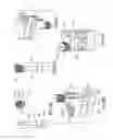 Fig. 09 - A PRECISION SURICAL GUIDANCE TOOL SYSTEM AND DELIVERY METHOD FOR IMPLEMENTING DENTAL IMPLANTS