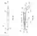 Fig. 06 - Corded Dental Handpiece