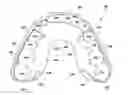 Fig. 01 - Dental Retainer