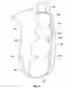 Fig. 04 - Dental Retainer