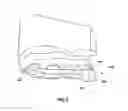 Fig. 07 - Dental Retainer