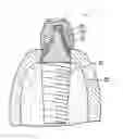 Fig. 01 - ABUTMENT HAVING A CORE