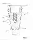 Fig. 03 - CONDENSING SKELETAL IMPLANT THAT FACILITATE INSERTIONS