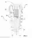 Fig. 06 - CONDENSING SKELETAL IMPLANT THAT FACILITATE INSERTIONS