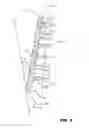 Fig. 07 - CONDENSING SKELETAL IMPLANT THAT FACILITATE INSERTIONS