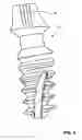 Fig. 10 - CONDENSING SKELETAL IMPLANT THAT FACILITATE INSERTIONS