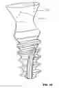 Fig. 11 - CONDENSING SKELETAL IMPLANT THAT FACILITATE INSERTIONS