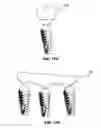Fig. 15 - CONDENSING SKELETAL IMPLANT THAT FACILITATE INSERTIONS