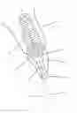 Fig. 01 - Dental restoration