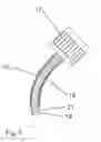 Fig. 06 - Dental restoration