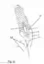 Fig. 07 - Dental restoration
