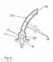 Fig. 09 - Dental restoration