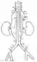 Fig. 01 - Vascular repair devices and methods of use
