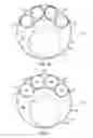 Fig. 07 - Vascular repair devices and methods of use