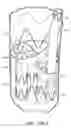 Fig. 18 - Vascular repair devices and methods of use