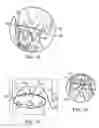 Fig. 22 - Vascular repair devices and methods of use