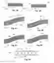 Fig. 03 - Vascular grafts with multiple channels and methods for making