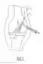 Fig. 02 - Reinforcement insert for tissue graft