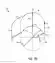Fig. 07 - Reinforcement insert for tissue graft