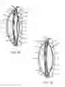 Fig. 14 - Intraocular cell migration inhibition system