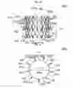 Fig. 04 - Stent member, artificial valve, and method of implanting the same