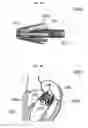 Fig. 05 - Stent member, artificial valve, and method of implanting the same