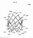 Fig. 06 - Stent member, artificial valve, and method of implanting the same
