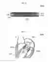 Fig. 08 - Stent member, artificial valve, and method of implanting the same