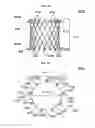 Fig. 10 - Stent member, artificial valve, and method of implanting the same