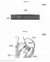 Fig. 14 - Stent member, artificial valve, and method of implanting the same