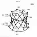 Fig. 17 - Stent member, artificial valve, and method of implanting the same
