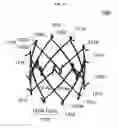 Fig. 23 - Stent member, artificial valve, and method of implanting the same
