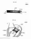 Fig. 27 - Stent member, artificial valve, and method of implanting the same
