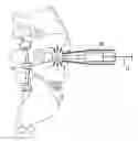 Fig. 01 - Aspirating Implants and Method of Bony Regeneration