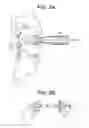 Fig. 03 - Aspirating Implants and Method of Bony Regeneration