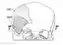 Fig. 01 - Patient-specific craniofacial implants