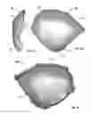 Fig. 04 - Patient-specific craniofacial implants