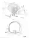 Fig. 05 - Patient-specific craniofacial implants