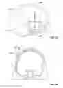 Fig. 06 - Patient-specific craniofacial implants