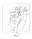 Fig. 03 - Prosthesis