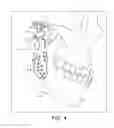 Fig. 05 - Prosthesis