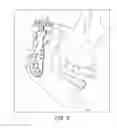 Fig. 06 - Prosthesis