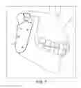 Fig. 08 - Prosthesis