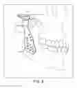 Fig. 09 - Prosthesis