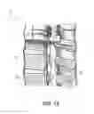 Fig. 08 - Intervertebral spinal implant and method