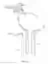 Fig. 04 - Spinal implant system and method