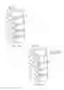 Fig. 02 - Intervertebral disc prosthesis and method