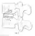 Fig. 06 - Intervertebral disc prosthesis and method