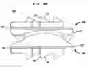 Fig. 08 - Intervertebral disc and insertion methods therefor
